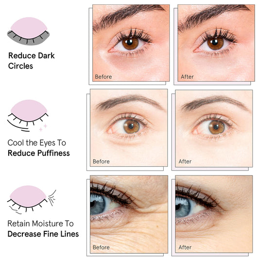 Gold_Under_Eye_Mask_(24_Pairs)_-_Reduce_Dark_Circles,_Puffy_Eyes,_Undereye_Bags,_Wrinkles_-_Gel_Under_Eye_Patches_-_Vegan_Cruelty_Free