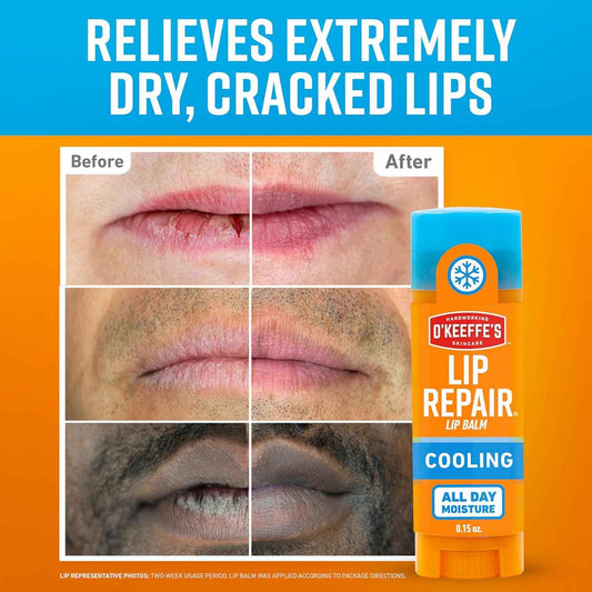 O'Keeffe's Lip Repair Lip Balm with Cooling Relief for Dry, Cracked Lips - Stick - Moisturizer for Very Dry Lips