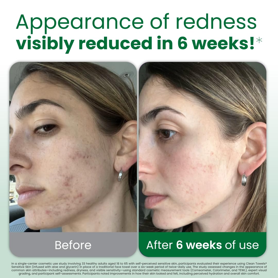 Clean_Skin_Club_Clean_Towels®_XL_Sensitive_Skin_|_Ultra-Soft_Disposable_Face_Towels_Infused_with_Aloe_&_Glycerin_|_Dermatologist-Approved_Towels_for_Sensitive_Skin,_Makeup_Remover_Dry_Wipes,_50_count