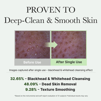Arencia_Korean_Rice_Mochi_Face_Cleanser_-_Face_Wash,_Gentle_Scrub_All_in_One_for_Deep_Cleansing,_Moisturizing,_Pore_Minimizing,_Acne-Prone_Skin,_Removing_Blackhead_with_Rice_Water_&_Green_Tea