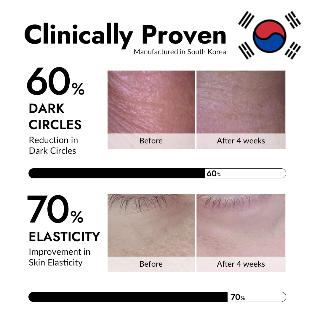 MIZON_Under_Eye_Patches_for_Puffy_Eyes_&_Dark_Circles,_24K_Gold_&_Snail_Mucin,_60_Pcs_–_Anti-Wrinkle_Collagen_&_Peptide_Formula_–_Moisturizing_Korean_Eye_Mask_for_Elasticity