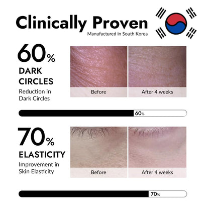 MIZON_Under_Eye_Patches_for_Puffy_Eyes_&_Dark_Circles,_24K_Gold_&_Snail_Mucin,_60_Pcs_–_Anti-Wrinkle_Collagen_&_Peptide_Formula_–_Moisturizing_Korean_Eye_Mask_for_Elasticity