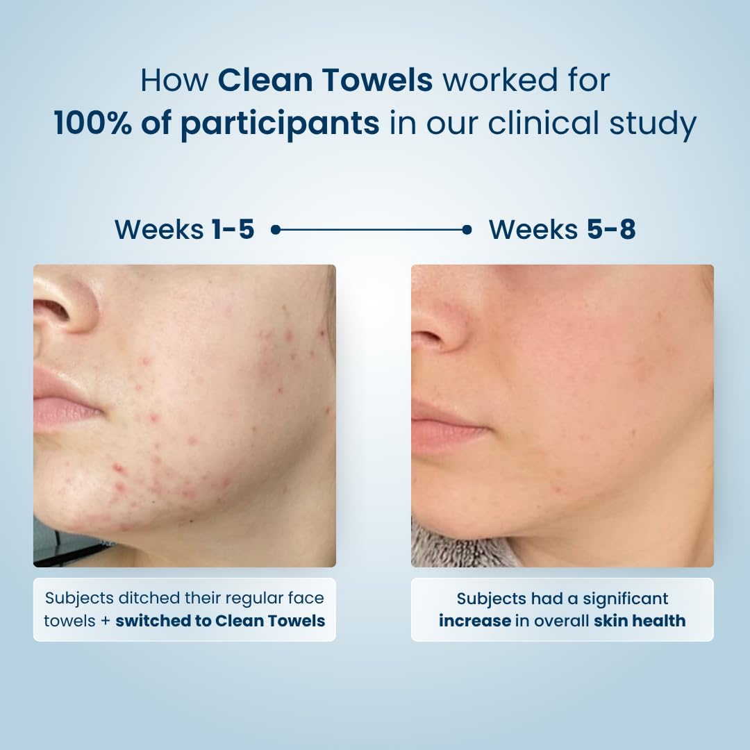 Clean_Skin_Club_Clean_Towels®,_100%_USDA_Biobased_Face_Towel,_Disposable_Face_Towelette,_Eczema_Association_Accepted,_Makeup_Remover_Dry_Wipes,_Ultra_Soft,_1_Pack,_25_Ct