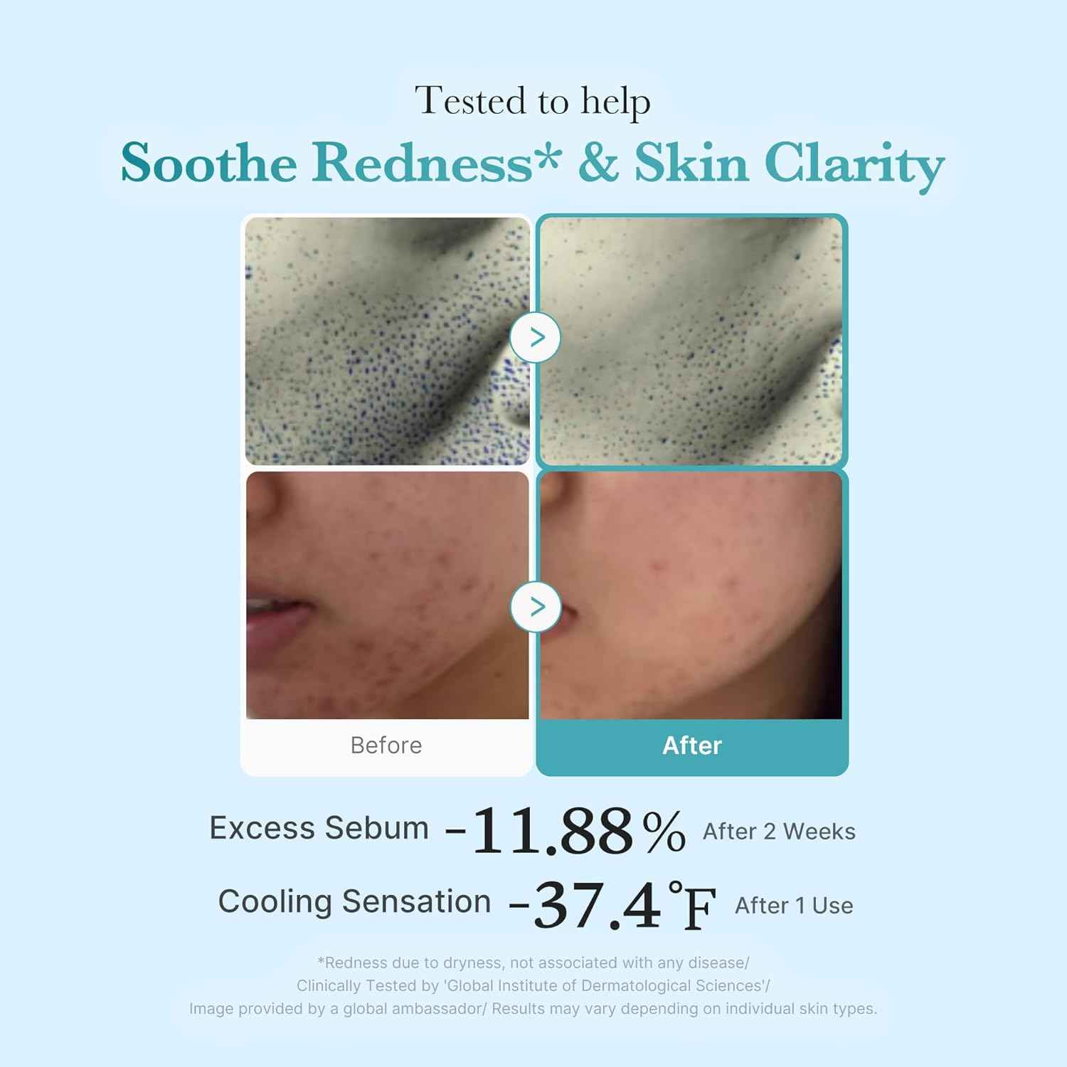 medicube Azelaic Acid Niacinamide Clarifying Toner | Troubled Skin Care, Ideal for Purifying & Calming | 4% Azelaic Acid & 2% Niacinamide| Soothing Daily Toner | Korean Skin Care | 8.45 fl.oz