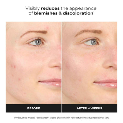 Paula's Choice BOOST 10% Azelaic Acid Booster Cream Gel Face Serum with Salicylic Acid, Oil-Free Skin Brightening Serum for Face, Fragrance-Free