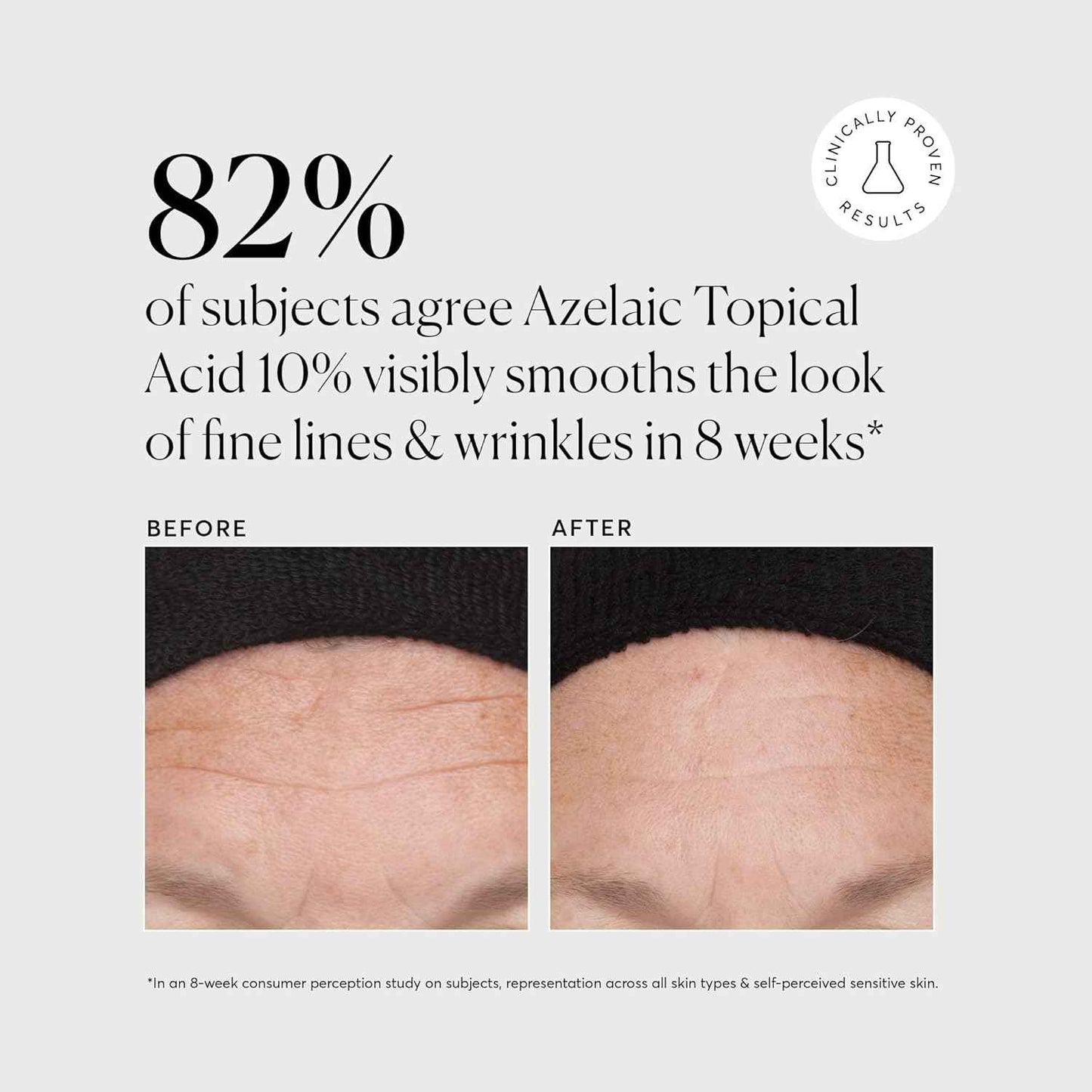 Naturium Azelaic Topical Acid 10%, Face & Skin Care Beauty Treatment with Niacinamide & Vitamin C