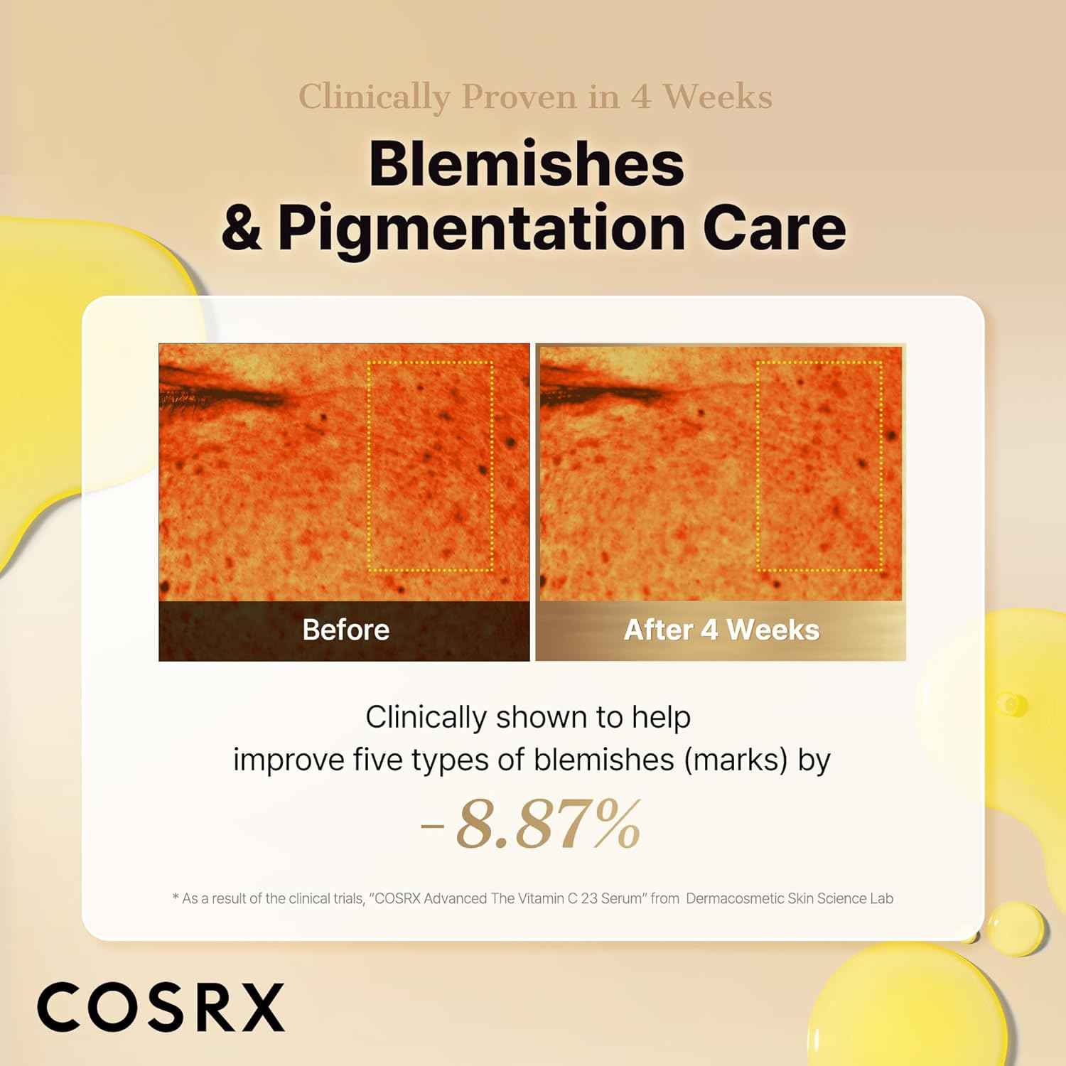 COSRX Advanced Pure Vitamin C 23% Serum with Vitamin E & Glutathione, Korean Vitamin C Serum for Fine Lines, Uneven Skin Tone & Dull Skin, 0.7oz, Korean Skin Care, Mothers Day Gifts for Mom & Wife