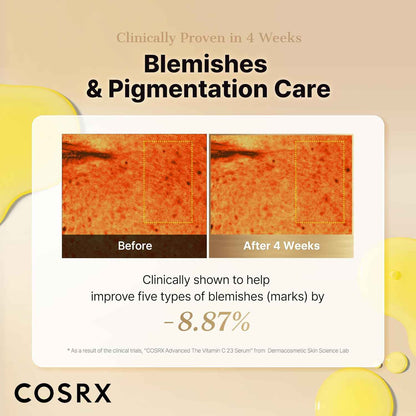 COSRX Advanced Pure Vitamin C 23% Serum with Vitamin E & Glutathione, Korean Vitamin C Serum for Fine Lines, Uneven Skin Tone & Dull Skin, 0.7oz, Korean Skin Care, Mothers Day Gifts for Mom & Wife