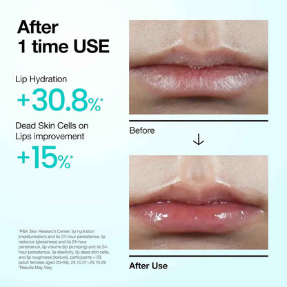 Anua PDRN Lip Serum, Long-lasting Hydration for Dry, Cracked Lips, Non-Sticky Moisturizing Lip Care with Salmon DNA, Hyaluronic Acid & Collagen, Korean Skincare, 0.33 fl.oz