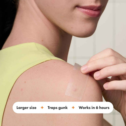 Mighty Patch Surface Large Pimple Patches for Face, Acne Spot Patch for Cheek, Forehead, and Chin, Pimple Stickers, Hydrocolloid Covers, Vegan-friendly, from Hero Cosmetics, 10 Count