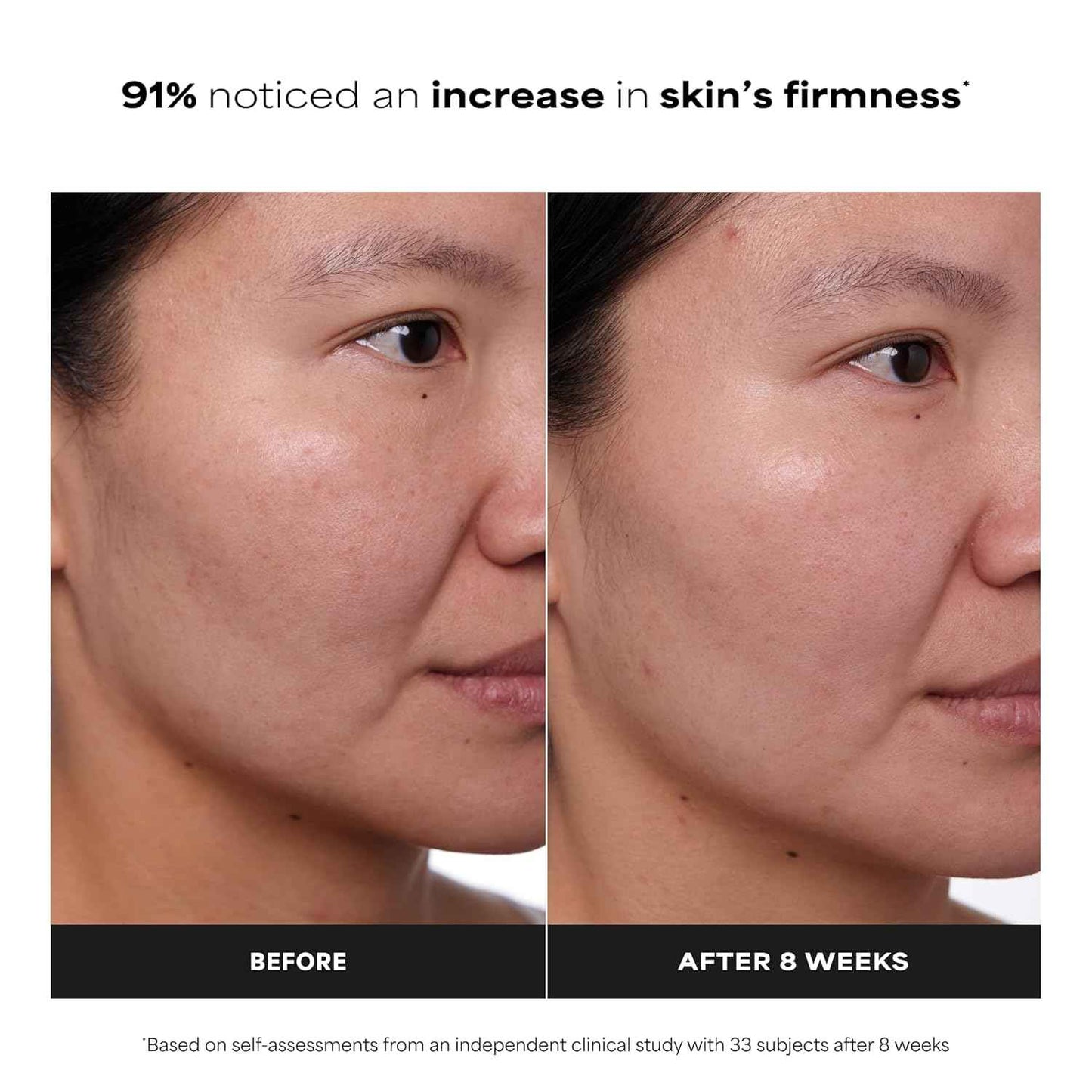 Paula's Choice CLINICAL 1% Retinol Face Treatment with Peptides, Vitamin C & Licorice Extract, Anti-Aging Skin Care Serum, Fine Lines & Wrinkles, Fragrance Free