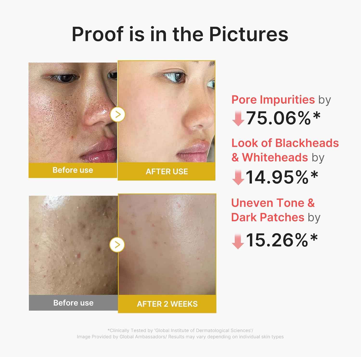 medicube Peel Shot | Reset in One Step | Gentle Exfoliating Serum with BHA, LHA, PHA for Dead Skin Cells, Blackheads, Excess Sebum | For Dull, Rough, Troubled Skin