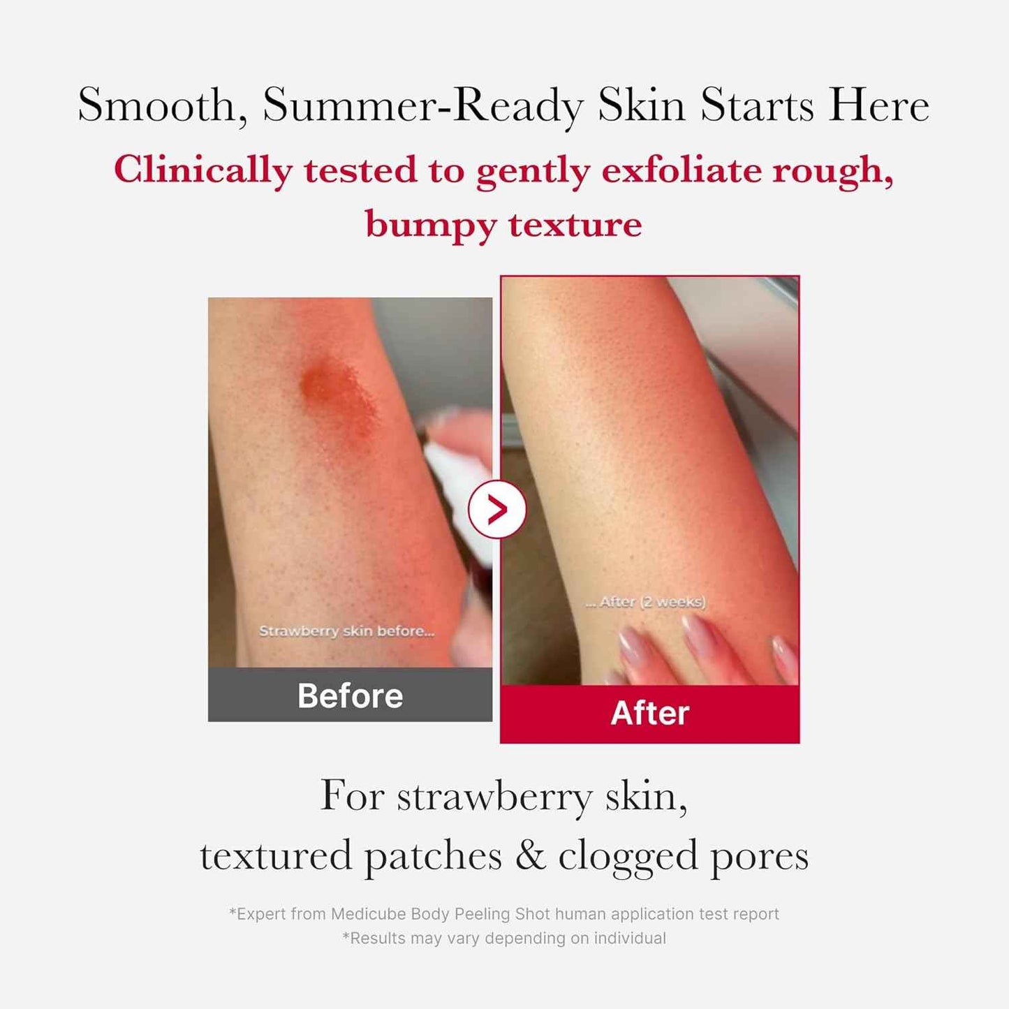 medicube Red Body Peeling Shot, AHA + BHA Exfoliating Body Spray for Summer-Ready Smooth Skin, Treats Strawberry Skin, Bumps & Breakouts, 3.88 oz
