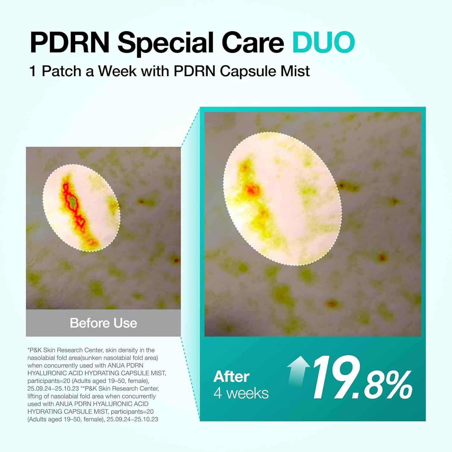 ANUA Salmon DNA PDRN Collagen Melting Patch for Glass skin, Smile Line Patches, Wrinkle Patches, Melting Thin Collagen Patch, Firming for Fine Lines, Glow, Korean Skincare, 2 Pairs x 4EA, Patch Only
