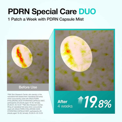 ANUA Salmon DNA PDRN Collagen Melting Patch for Glass skin, Smile Line Patches, Wrinkle Patches, Melting Thin Collagen Patch, Firming for Fine Lines, Glow, Korean Skincare, 2 Pairs x 4EA, Patch Only