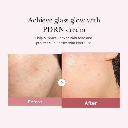medicube PDRN Pink Hyaluronic Moisturizing Cream | Blemish Recovery, Relief & Hydrating Care | Restores Skin Elasticity & Glow | Korean Skincare for Even Skin Tone & Pore Care