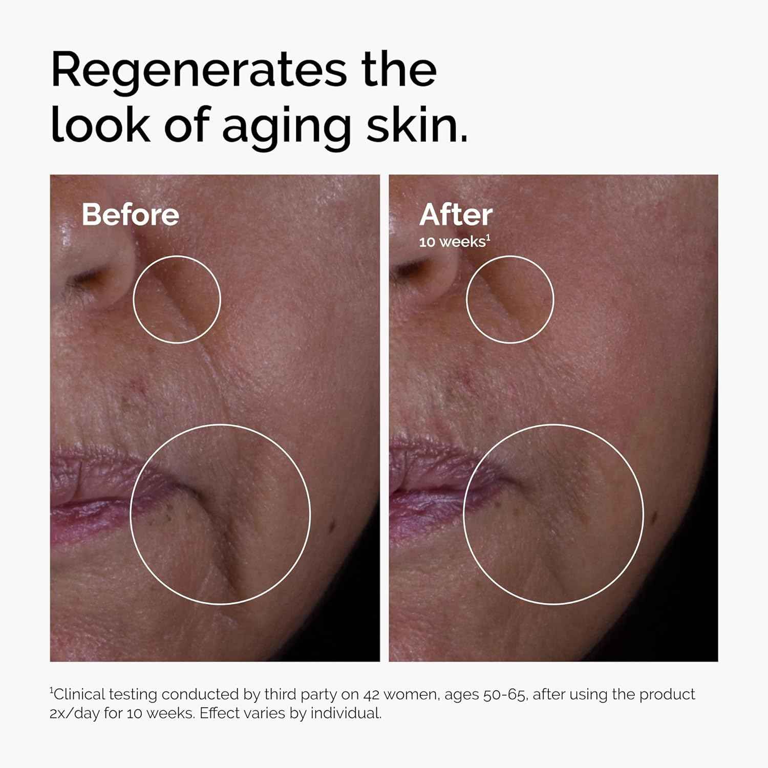 The Ordinary GF 15% Solution, Anti-Aging Formula for Visible Skin & Wrinkle Repair, 1 Fl Oz