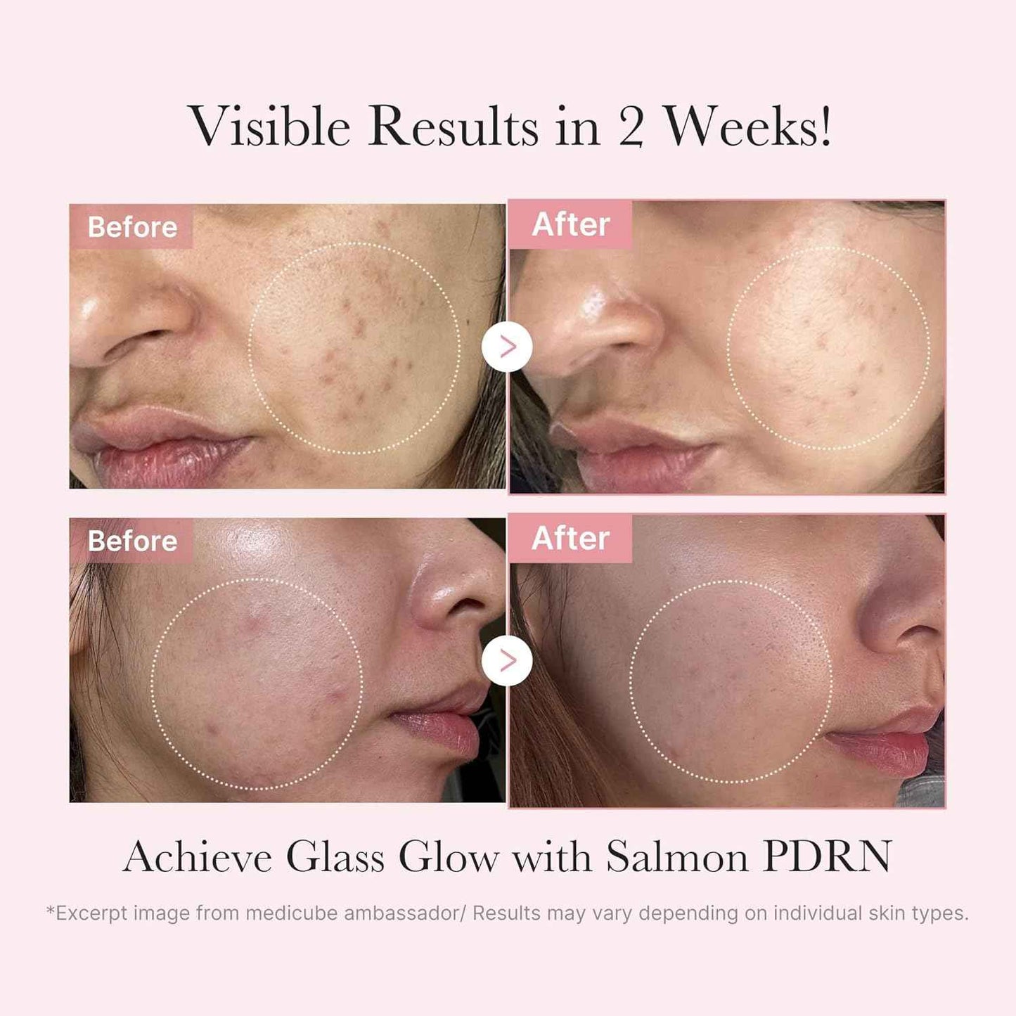 medicube Salmon DNA PDRN Trial Kit | Glass Glow Mini Skincare Set with Toner, Serum & Sheet Mask for Hydrating, Firming, Moisturizing |Gift & Travel Essentials for Women & Girls | Korean Skincare