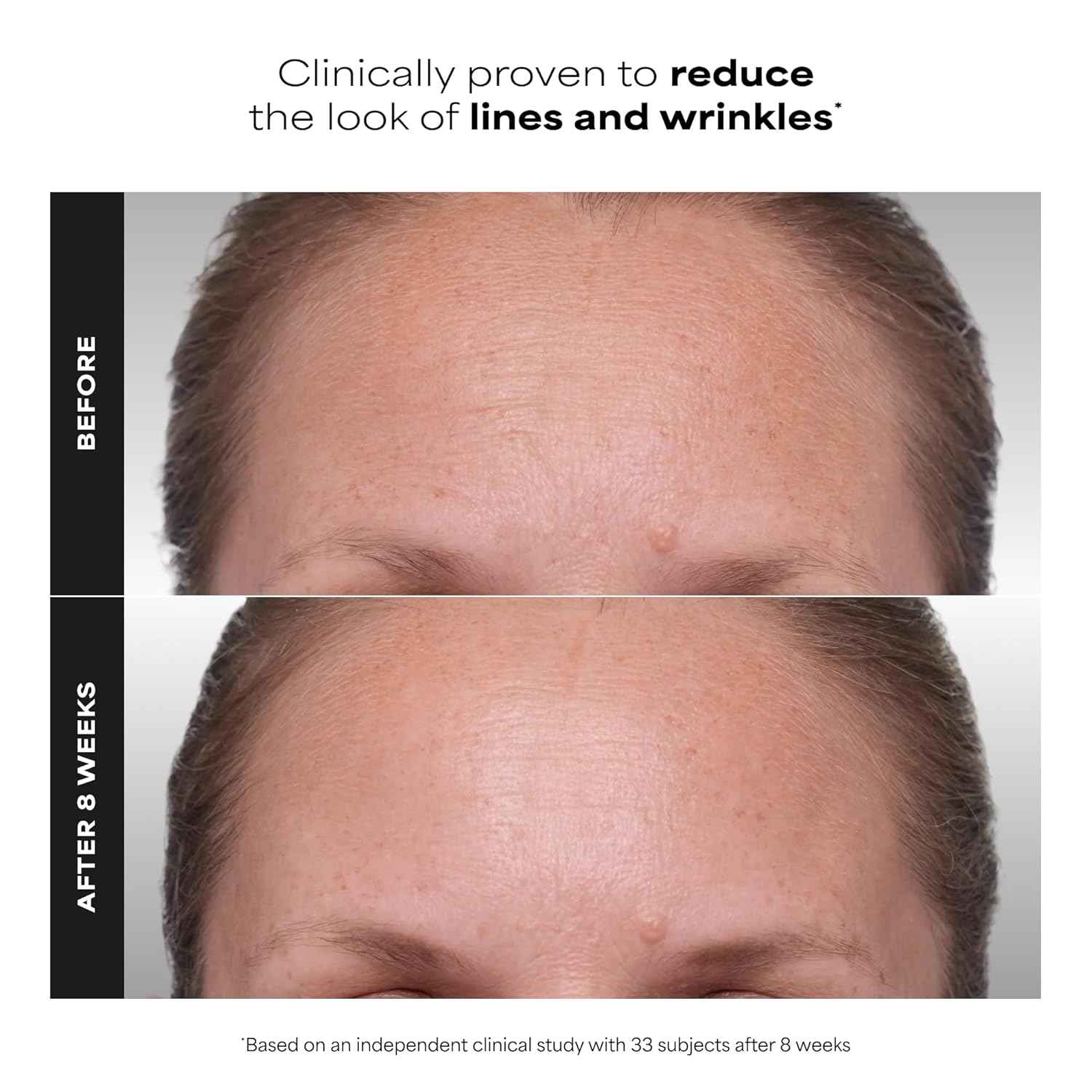 Paula's Choice CLINICAL 1% Retinol Face Treatment with Peptides, Vitamin C & Licorice Extract, Anti-Aging Skin Care Serum, Fine Lines & Wrinkles, Fragrance Free