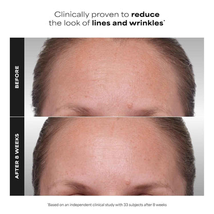 Paula's Choice CLINICAL 1% Retinol Face Treatment with Peptides, Vitamin C & Licorice Extract, Anti-Aging Skin Care Serum, Fine Lines & Wrinkles, Fragrance Free