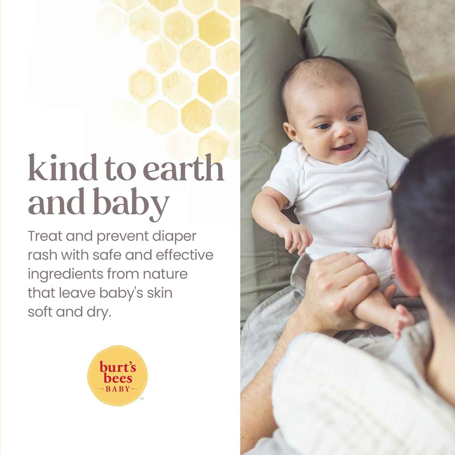 Burt's Bees Baby Diaper Rash Ointment, Maximum Strength, 40% Zinc Oxide, 100% Natural Origin, Pediatrician Tested