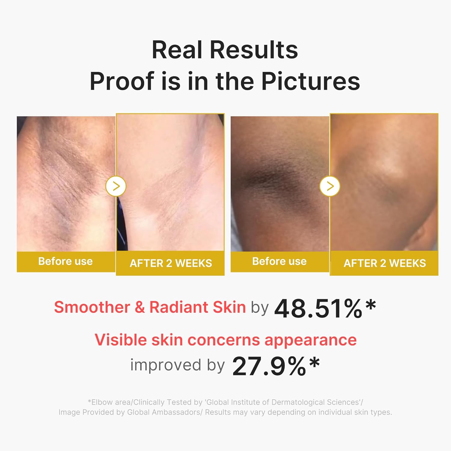 medicube_Body_Peel_Shot_with_Turmeric_|_Gentle_Body_Exfoliating_Serum_with_BHA,_LHA_&_PHA_for_Dead_Skin_Cells,_Uneven_Looking_Skin_&_Excess_Sebum_|_9.46_fl.oz