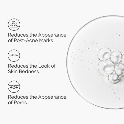 The_Ordinary_Aloe_2%_+_NAG_2%_Solution,_Soothes_Skin_and_Targets_Post-Acne_Marks,_1_Fl_Oz