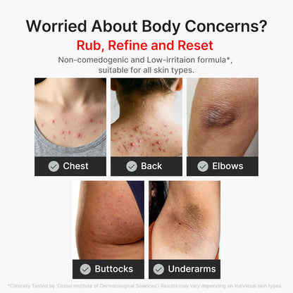 medicube_Body_Peel_Shot_with_Turmeric_|_Gentle_Body_Exfoliating_Serum_with_BHA,_LHA_&_PHA_for_Dead_Skin_Cells,_Uneven_Looking_Skin_&_Excess_Sebum_|_9.46_fl.oz