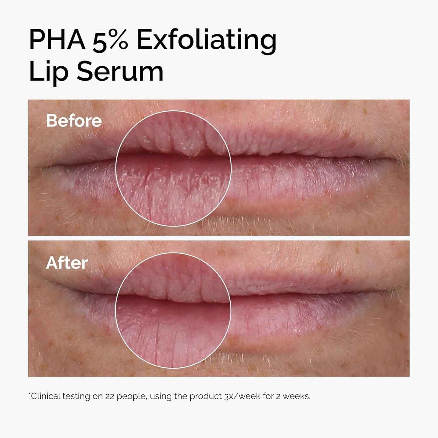 The Ordinary PHA 5% Exfoliating Lip Serum, Hydrating Overnight Lip Exfoliator Treatment, 0.5 Fl Oz