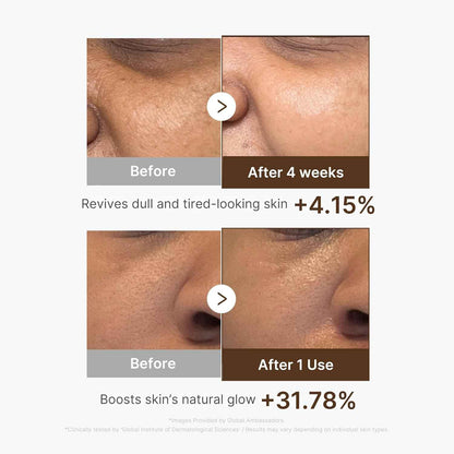 medicube Deep Vitamin C Capsule Serum | Hydrating Vitamin C Serum for Dull & Uneven-Looking Skin with Visible Concerns | Liposome Capsules for Smooth, Radiant Texture | Korean Skincare 1.01 fl.oz
