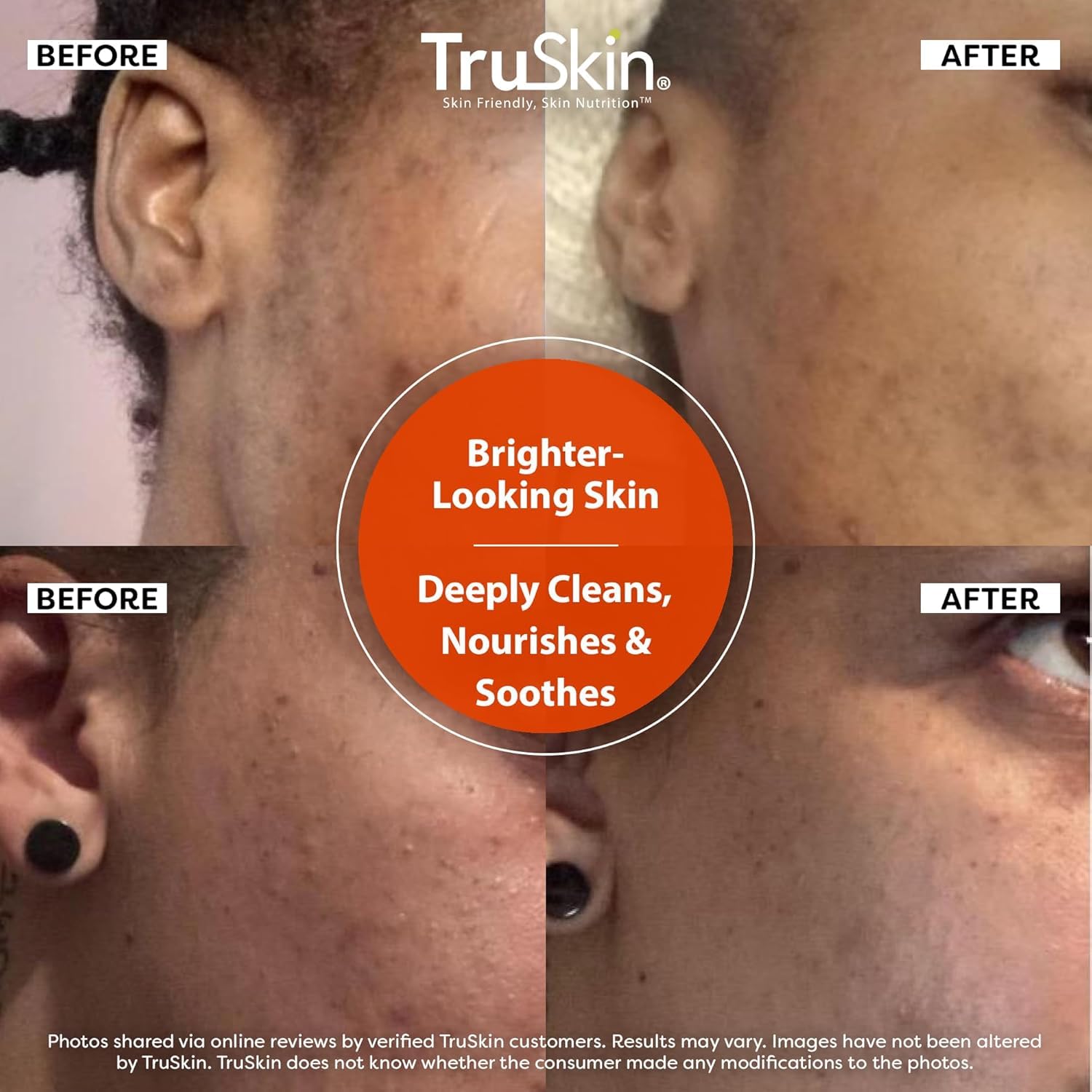 TruSkin_Vitamin_C_Face_Wash_Cleanser_-_Brightening_Facial_Cleanser_with_Vitamins_C_&_E,_Rosehip_Oil,_Aloe_Vera_&_MSM_-_Gently_Cleanses,_Refreshes_&_Supports_Radiant_Skin_-_4_fl_oz