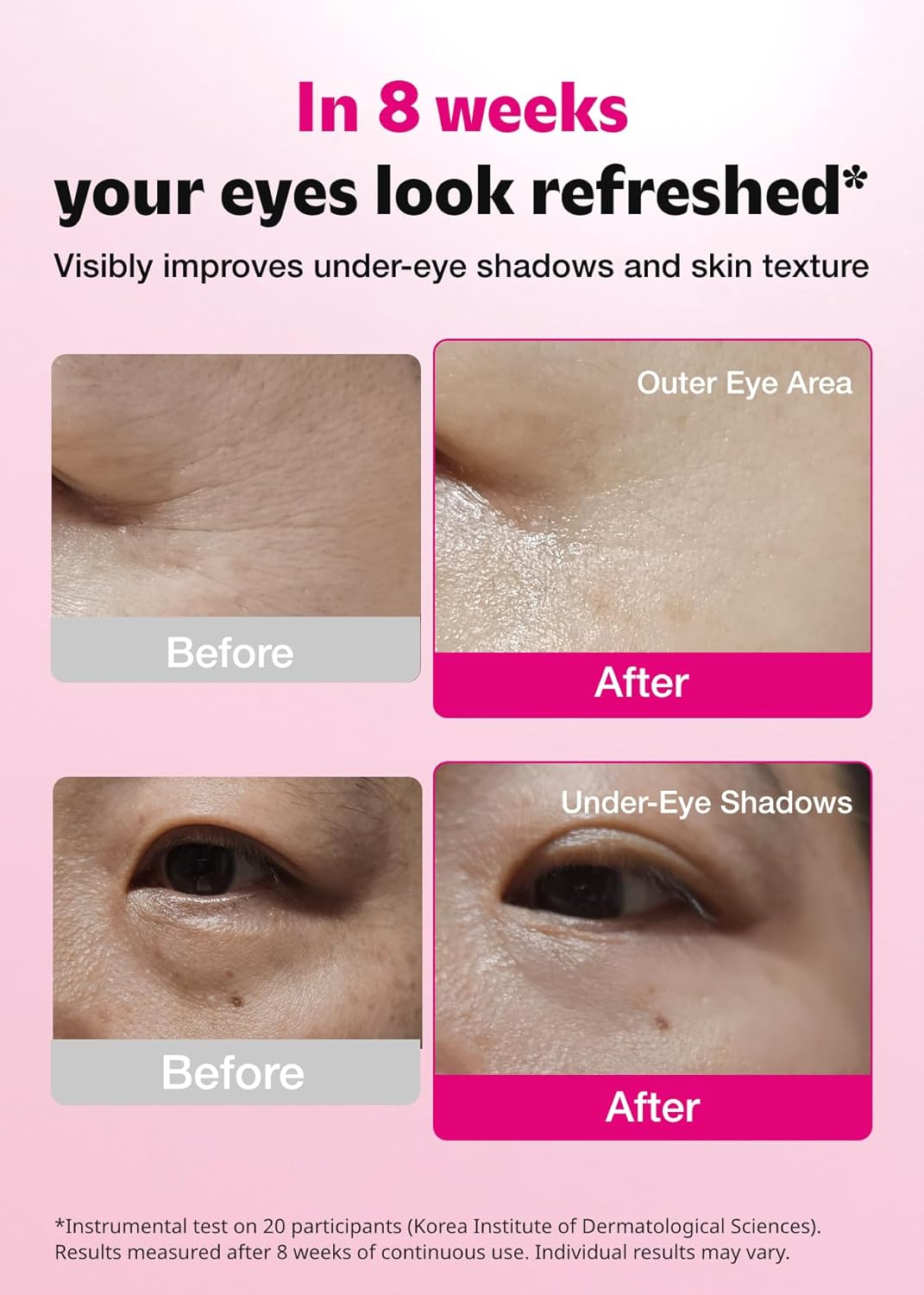 ISOI_Blemish_Care_Under_Eye_Patch_for_Dark_Circles,_Puffiness_and_Wrinkles,_Hydrating_Gel_Eye_Masks_with_Hyaluronic_Acid_&_Bulgarian_Rose_Oil,_Korean_Skin_Care_(90_pcs,_3.17_oz)