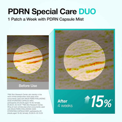 Anua PDRN Collagen Melting Patch for Neck, Lifting and Firming, Thin Film for Neck Fine Lines & Forehead, Plumping Effect with Salmon DNA, Korean Skincare, 0.02g x 4EA, Patch Only