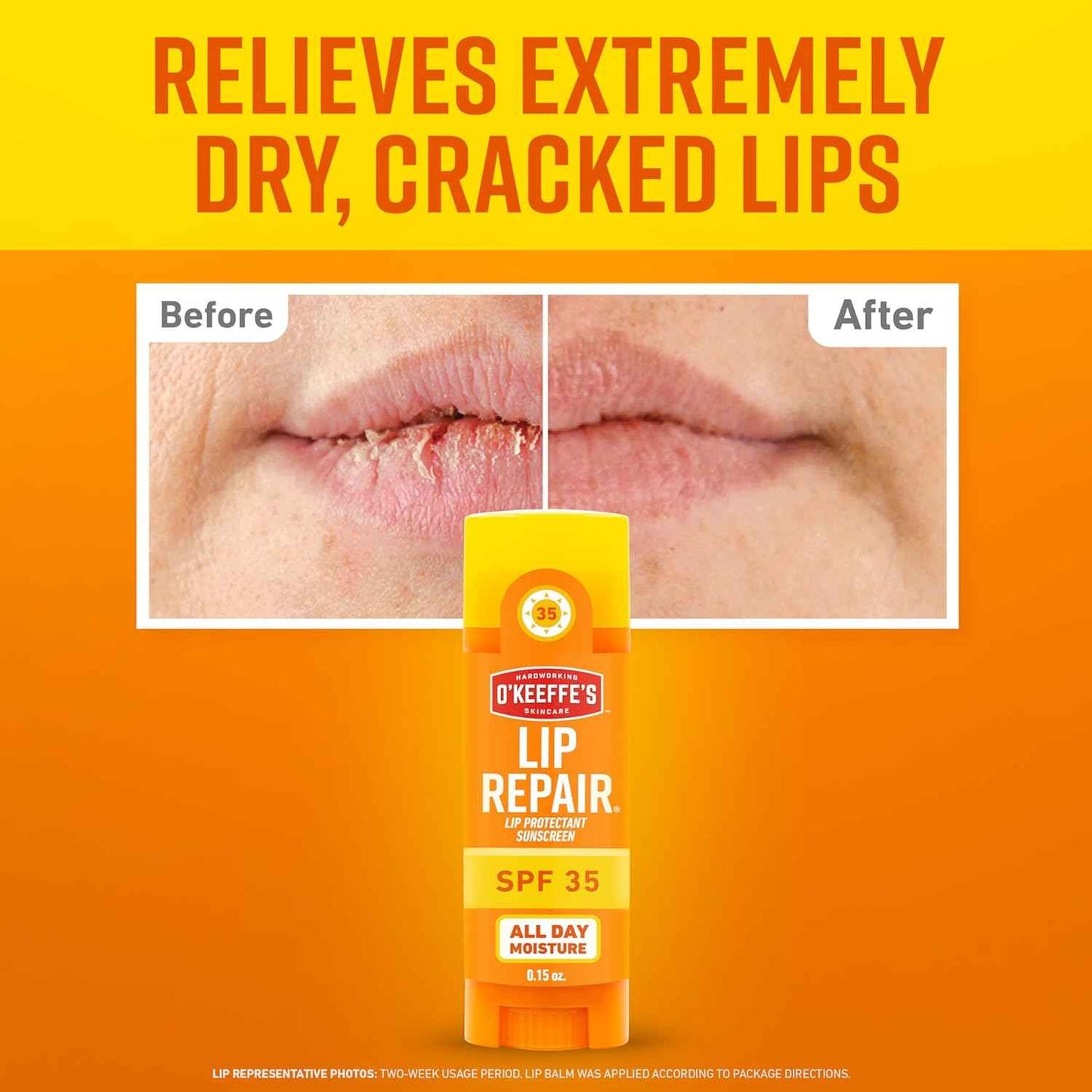 O'Keeffe's Lip Repair SPF 35 Lip Balm - Stick - Sun-Safe Moisturizer for Extremely Cracked, Dry Lips
