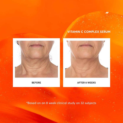Naturium Vitamin C Complex Face Serum Jumbo, Anti-Aging Facial Treatment with Hyaluronic Acid & Vitamin E