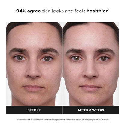 Paula's Choice CLINICAL 1% Retinol Face Treatment with Peptides, Vitamin C & Licorice Extract, Anti-Aging Skin Care Serum, Fine Lines & Wrinkles, Fragrance Free