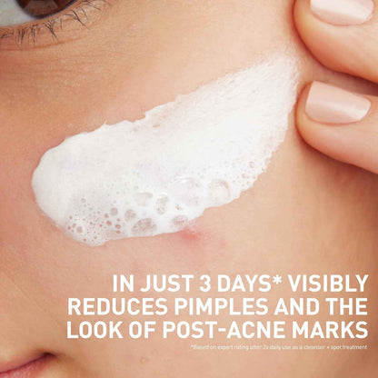 CeraVe Clay To Foam Acne Face Wash, Multi-Use Salicylic Acid & Kaolin Clay Acne Spot Treatment Clears Pimples & Blackheads, Prevents Breakouts, Hydrates & Soothes, Fragrance-Free, Non-Comedogenic, 4oz