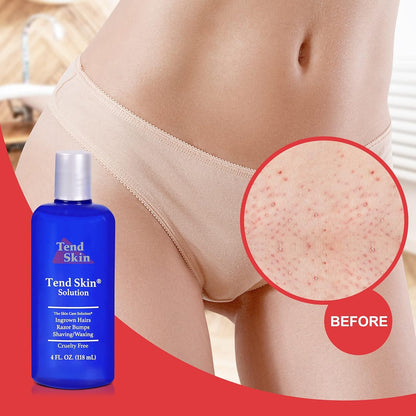 Tend_Skin_Womens_AfterShave/Post_Waxing_Solution_for_Ingrown_Hair,_Razor_Bumps_and_Burns,_4_ounce,_Blue