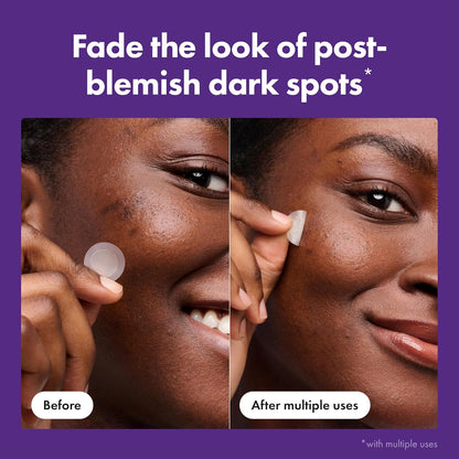 Mighty_Patch_Hero_Cosmetics_Micropoint™_for_Dark_Spots_-_Post-Blemish_Dark_Spot_Patch_with_395_Micropoints,_Dermatologist_Tested_and_Non-irritating_(8_Count)