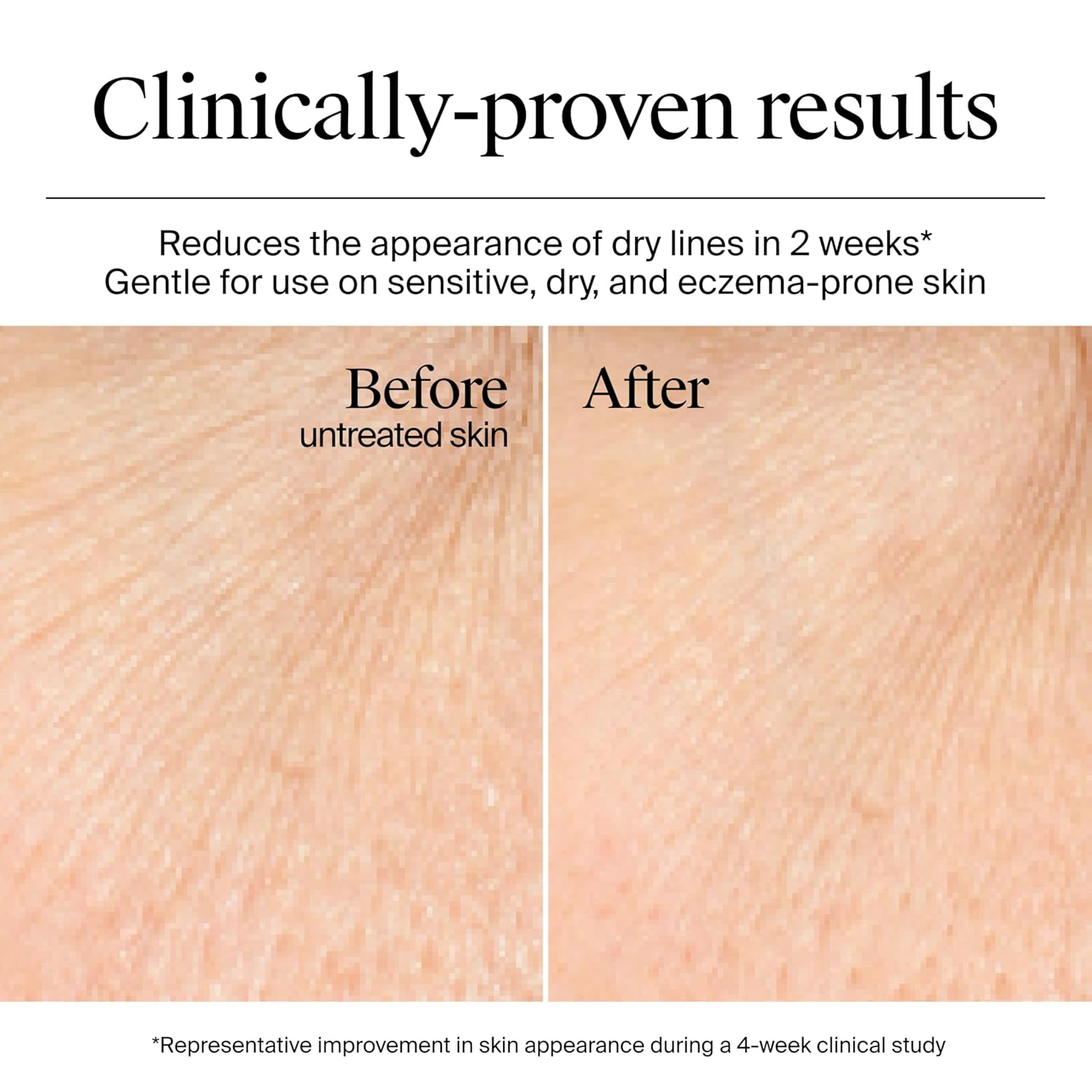 Neutrogena_Hydro_Boost_Gel_Cream,_48_Hr_Hydration_for_Normal/Dry_Skin,_Fragrance_Free,_Face_Moisturizer_with_Hyaluronic_Acid,_1.7_oz._&_Trial_Size_Hydro_Boost_Hydrating_Gel_Cleanser,_0.5_fl_oz