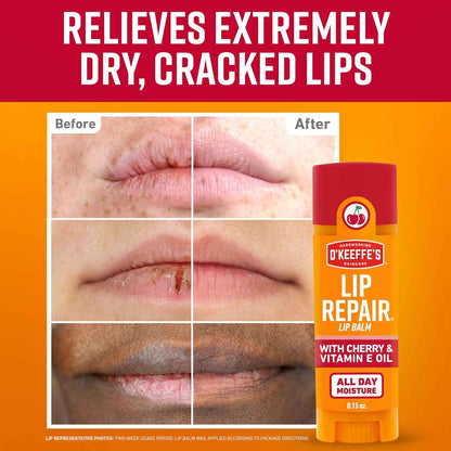 O'Keeffe's Lip Repair Lip Balm with Cherry & Vitamin E Oil - Stick - Moisturizer for Extremely Cracked, Dry Lips