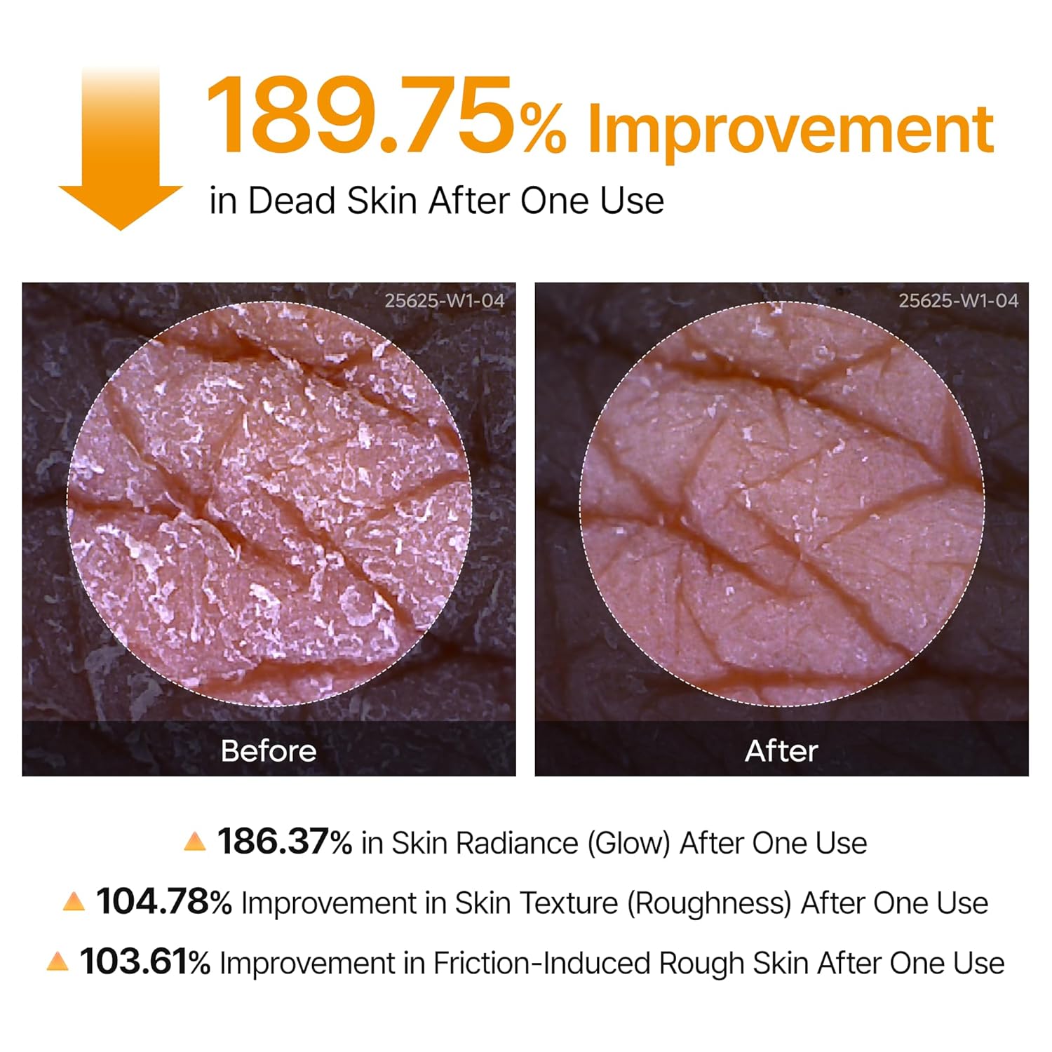 Dr.Melaxin_Body_Keratin_Care_Kojic_Acid_Turmeric_Spray_Gently_Exfoliating_Peeling_Solution_Korean_Skincare_All_Skin_Types_200ml