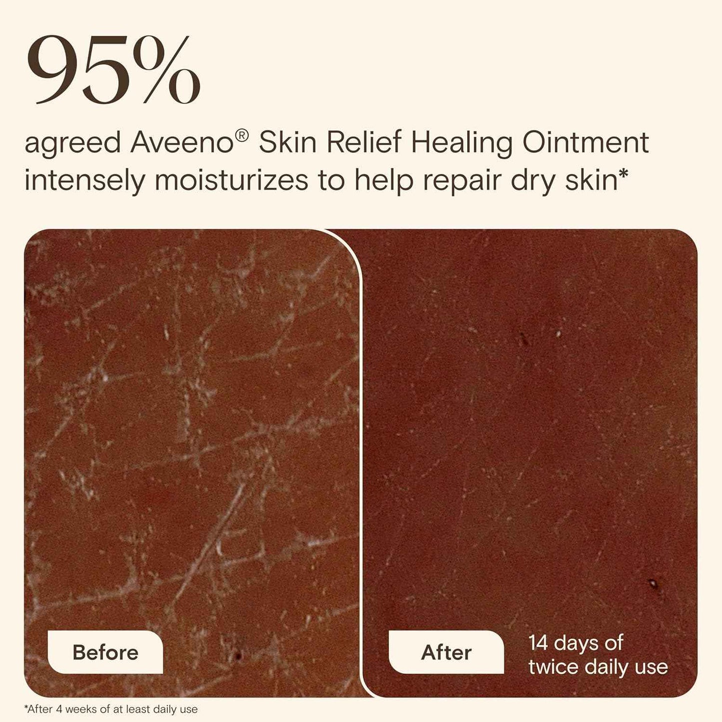 Aveeno Skin Relief Healing Ointment, for Extra Dry, Cracked & Sensitive Skin, 72-Hour Protectant with Triple Oat, Shea Butter & Glycerin, Fragrance-Free for Body, Face, Hands, Lips