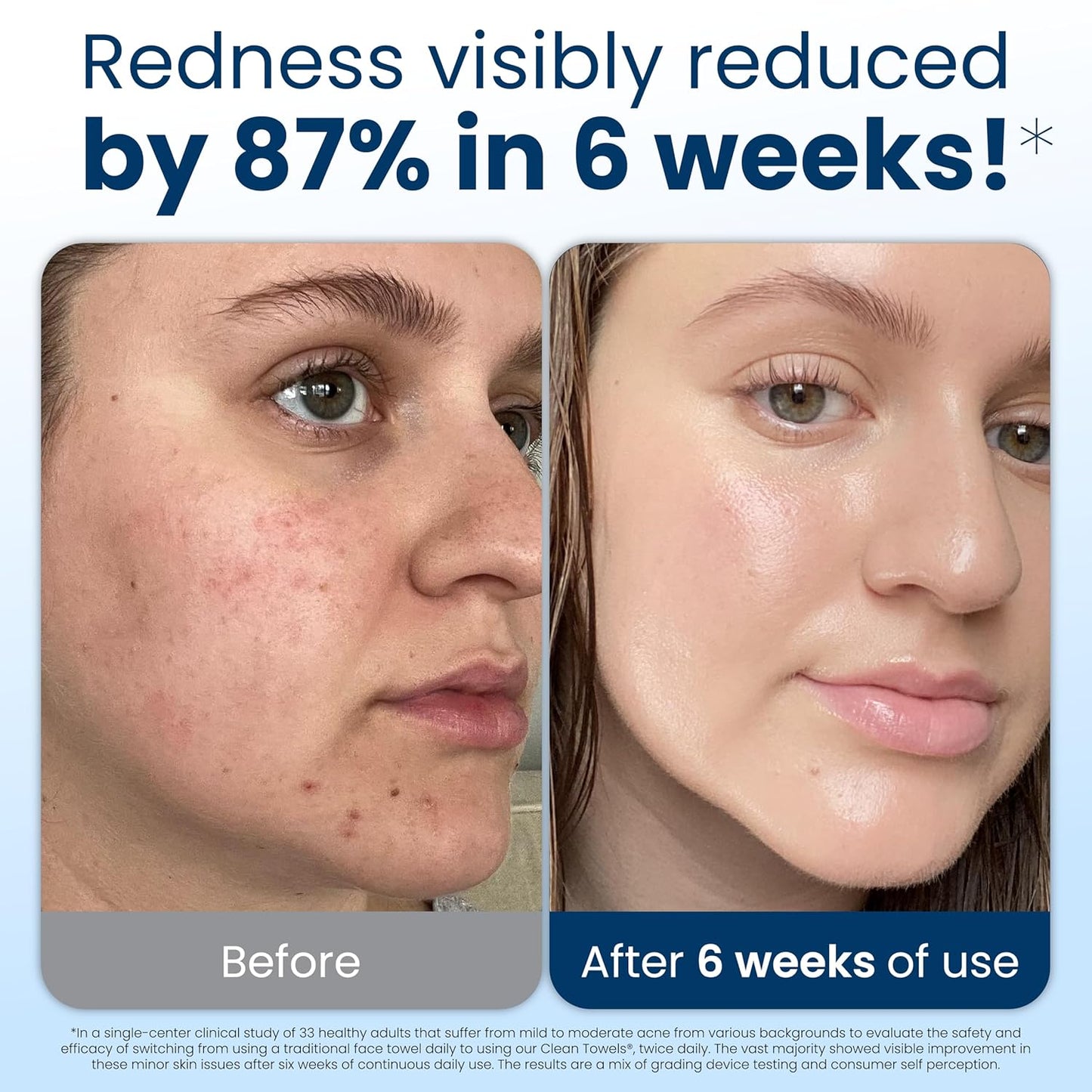 Clean_Skin_Club_Clean_Towels_XL®,_100%_USDA_Biobased_Face_Towel,_Disposable_Face_Towelette,_Eczema_Association_Accepted,_Makeup_Remover_Dry_Wipes,_Ultra_Soft,_1_Pack,_50_Ct