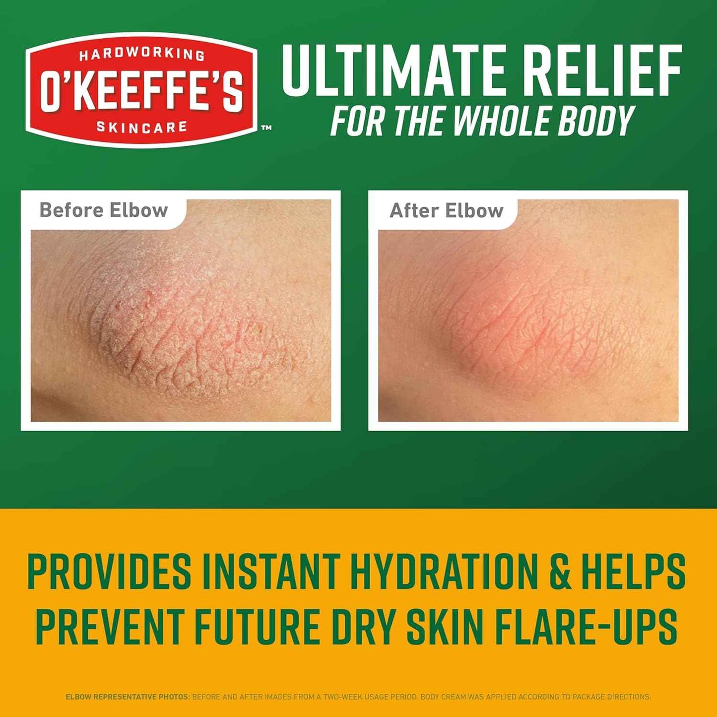 O’Keeffe’s Skin Repair Relief Body Cream, 7oz Tube (Pack of 1) – for the Most Severe Dry Skin