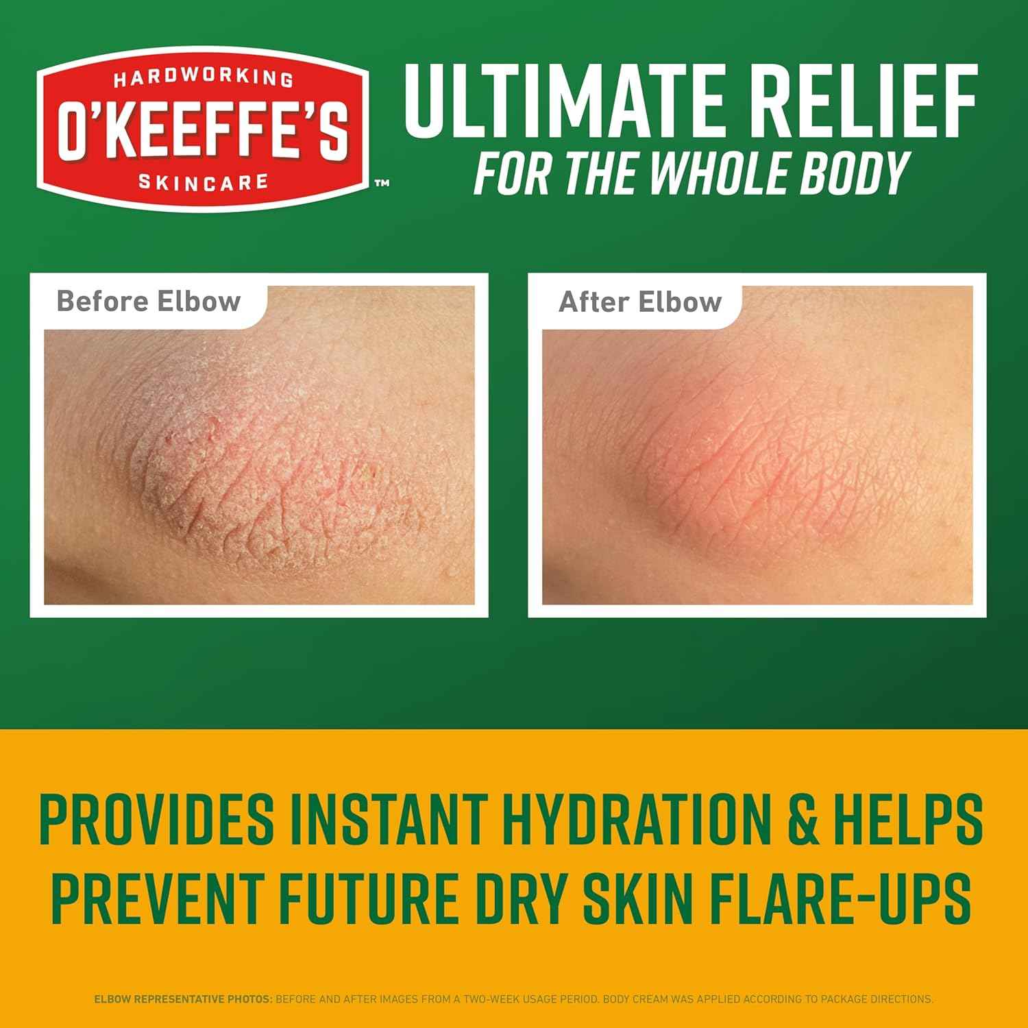 O’Keeffe’s Skin Repair Relief Body Cream, 7oz Tube (Pack of 1) – for the Most Severe Dry Skin