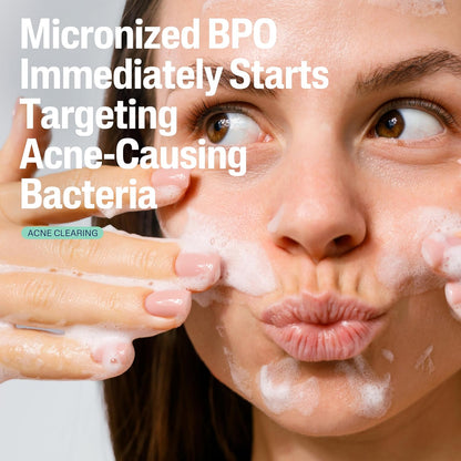 Cetaphil_Gentle_Clear_Complexion-Clearing_BPO_Acne_Cleanser_with_2.6%_Benzoyl_Peroxide,_Creamy_and_Soothing_for_Sensitive_Skin,_Suitable_for_All_Skin_Types,_4.2oz