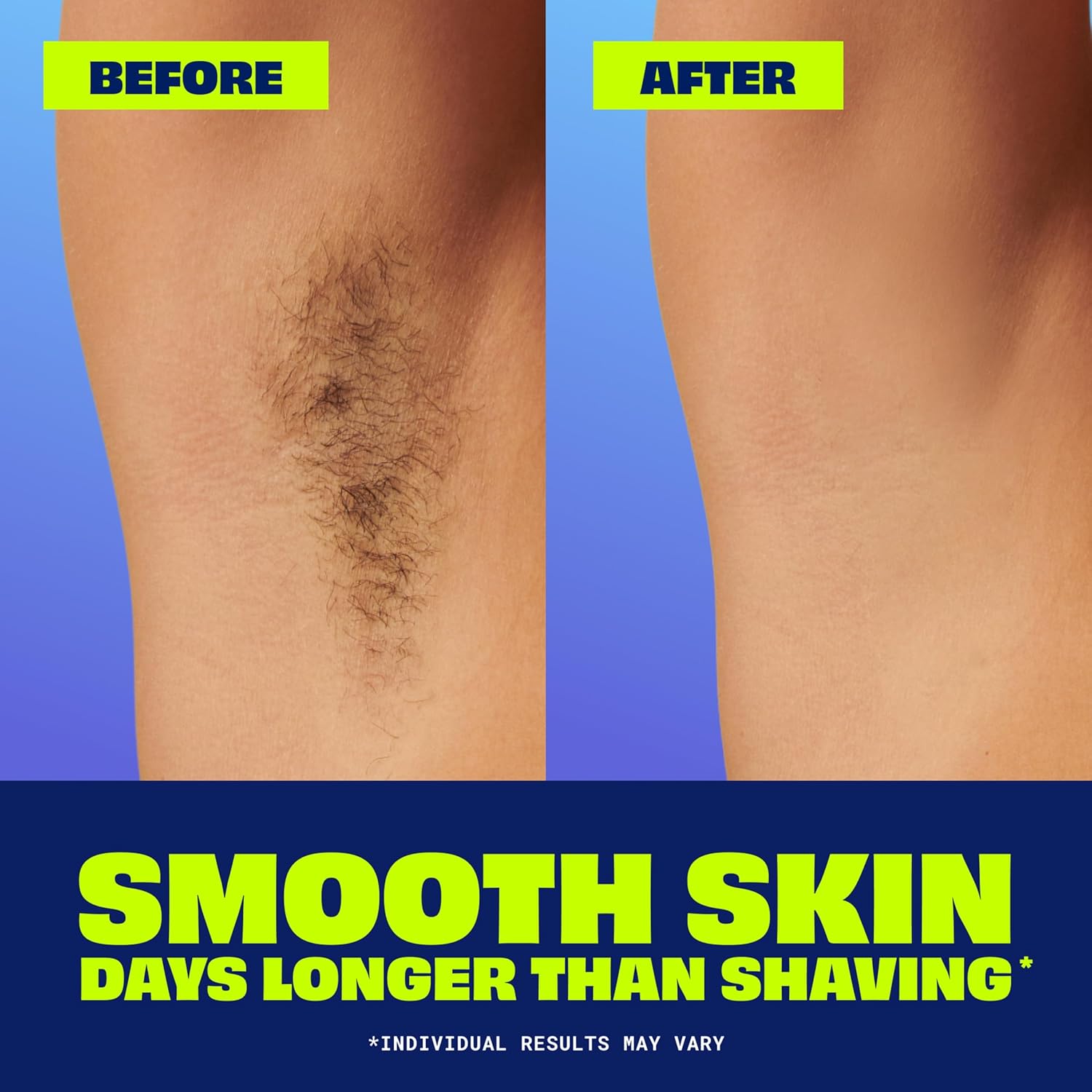 Nair_Sensitive_Formula_Glide_On,_Hands-Free_Applicator_Hair_Removal_Cream_with_Coconut_Oil_and_Vitamin_E_for_Body,_3.3_oz 