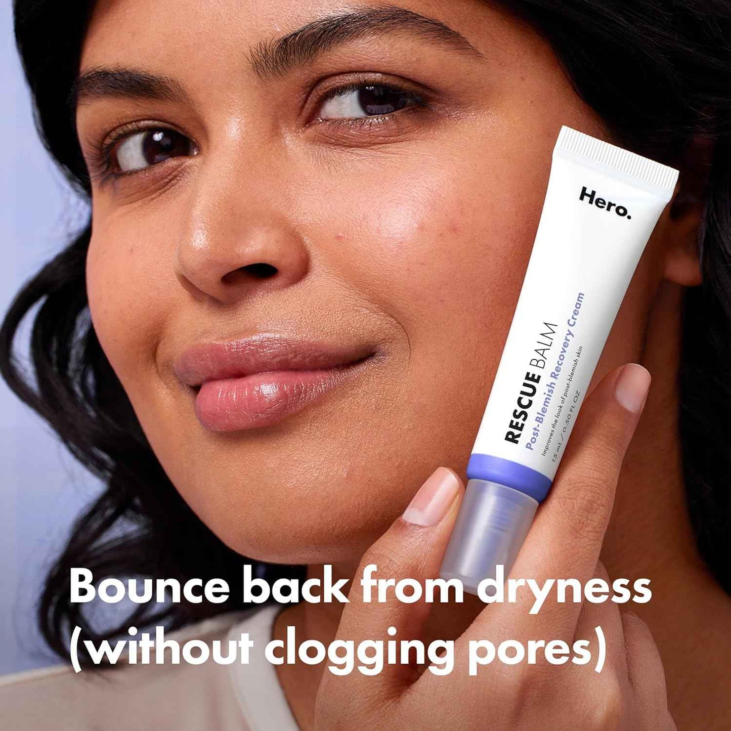 Hero Cosmetics Rescue Balm (New Formula)-The Post-Blemish Cream to Boost Hydration and Improve the Look of Post-Blemish Marks. Derm-Tested. New Formula. Won’t Clog Pores. 15mL