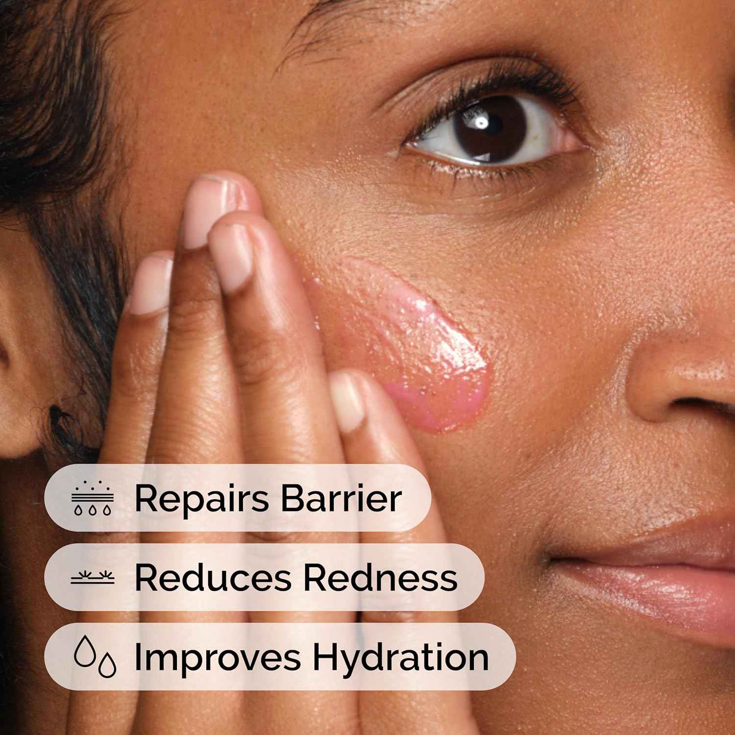 The Ordinary Soothing & Barrier Support Serum, Redness-Reducing & Hydrating Solution with Centella Asiatica for Skin Barrier Repair